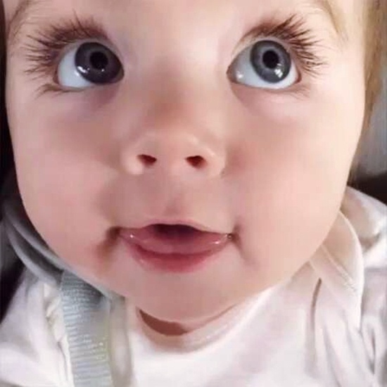 ทารกแรกเกิดตาขาว